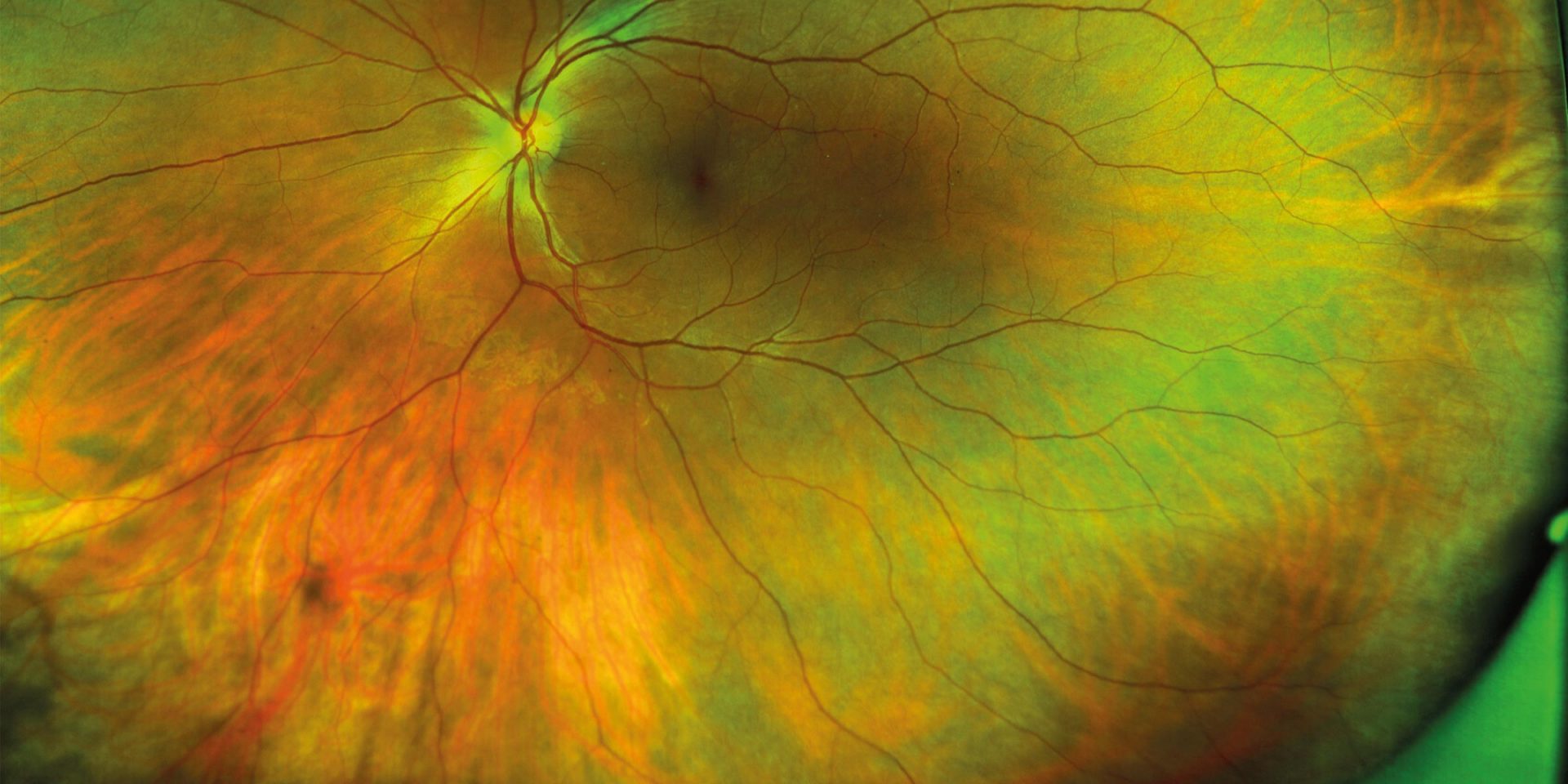 optos - Technology - Burnett Hodd & Tam Technology